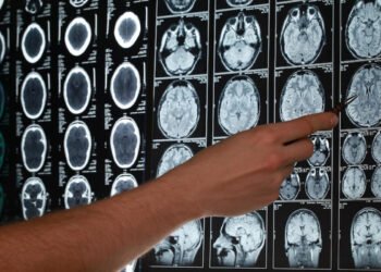 Una conexión neuronal sería la causa de la necesidad de aislamiento social durante una infección