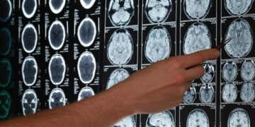 Una conexión neuronal sería la causa de la necesidad de aislamiento social durante una infección